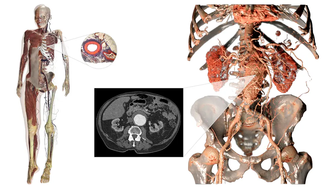 Anatomage Table Classic