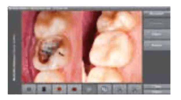 KAPS Medical Workstation