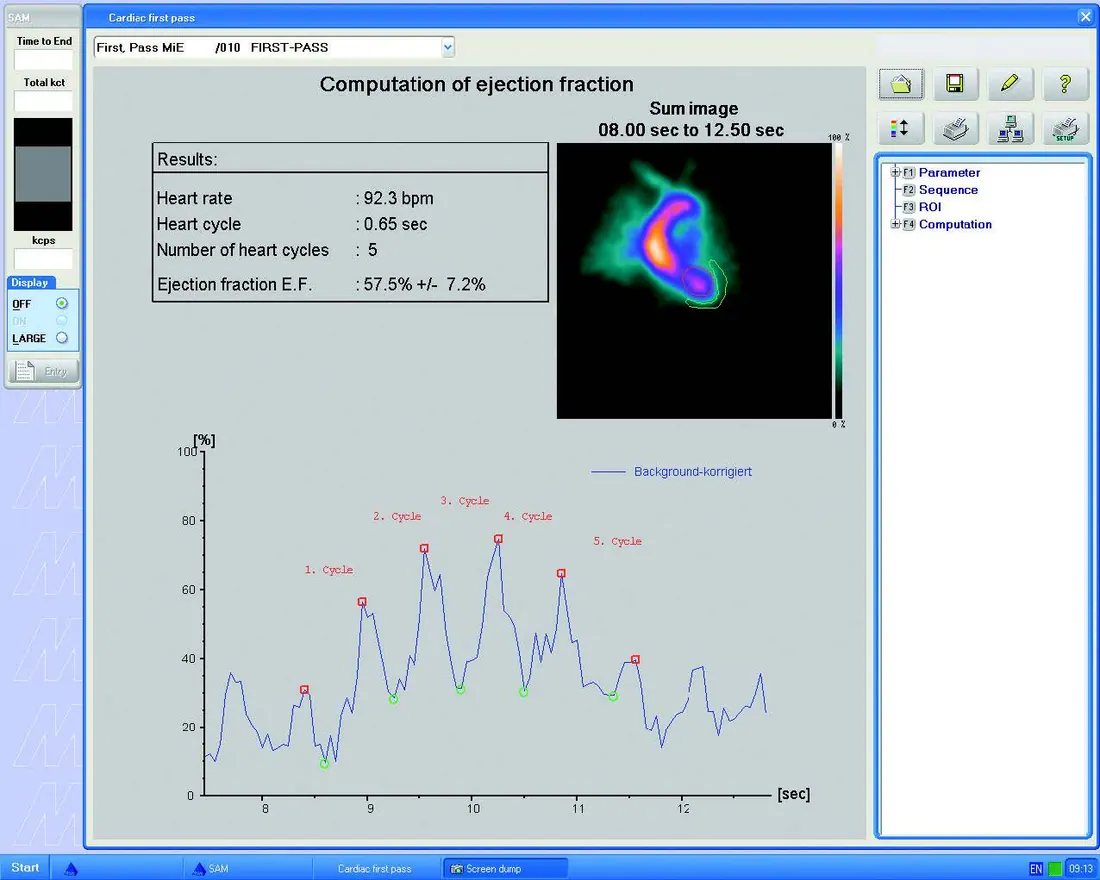 Cardiac First-Pass