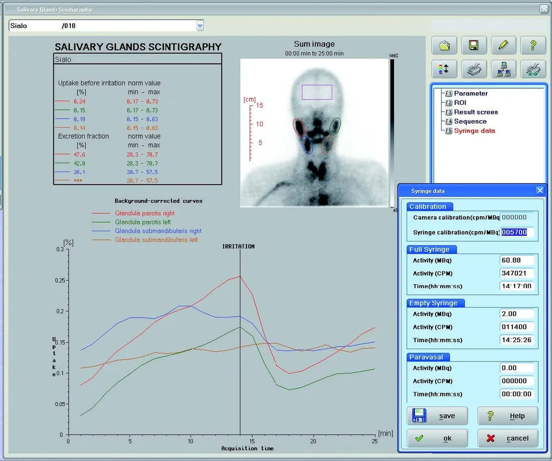 DYNAX - Renal Scintigraphy