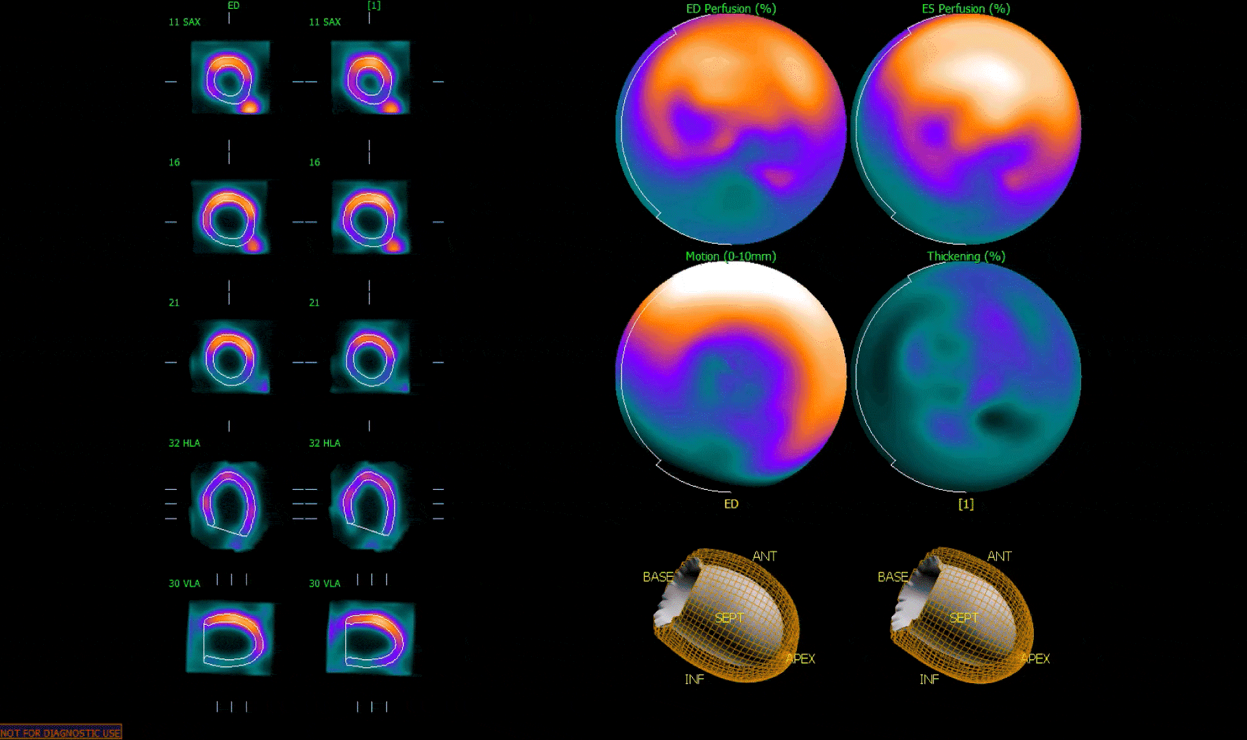 TruFlow Dynamic Imaging. Manufacturer TruFlow software demonstration.