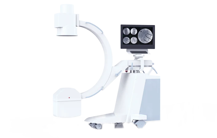 Perlove PLX116A1 Mobile C-arm. Manufacturer family image; confirm the selected configuration.
