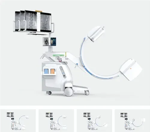 Perlove PLX118C Series Integrated FPD C-arm. Manufacturer family image; confirm the selected configuration.